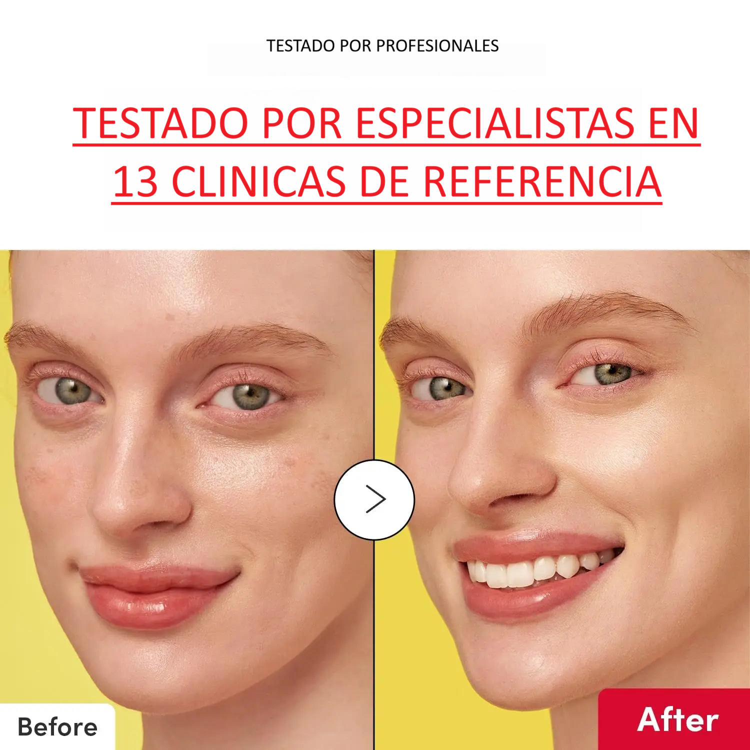 Serum de niacinamida antiage